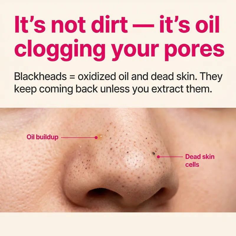 PoreVac Pro™ Deep Pore Vacuum