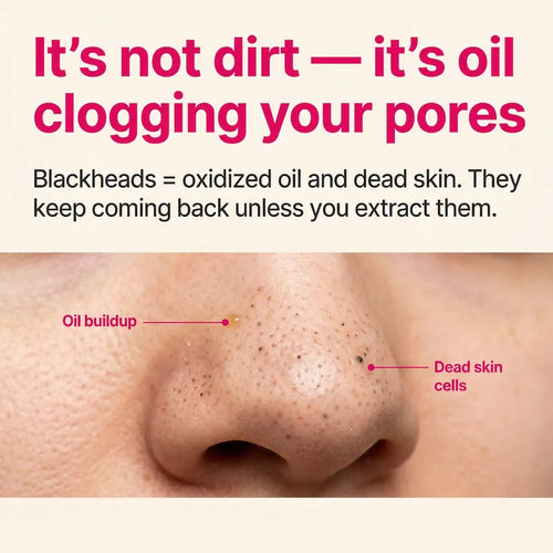 PoreVac Pro™ Deep Pore Vacuum