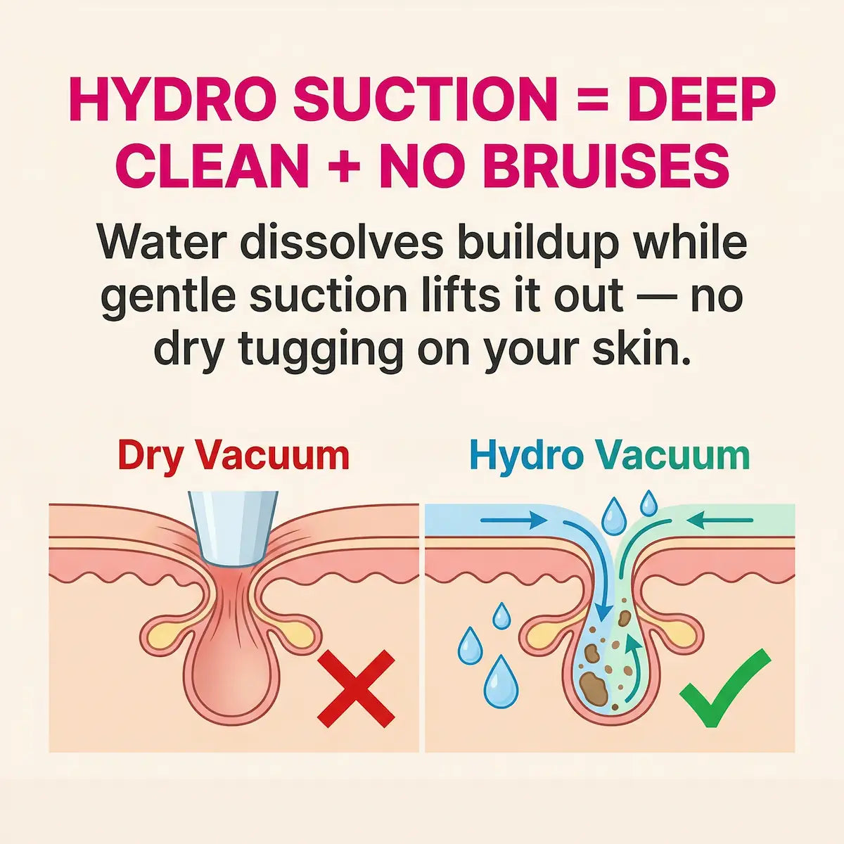 PoreVac Pro™ Deep Pore Vacuum