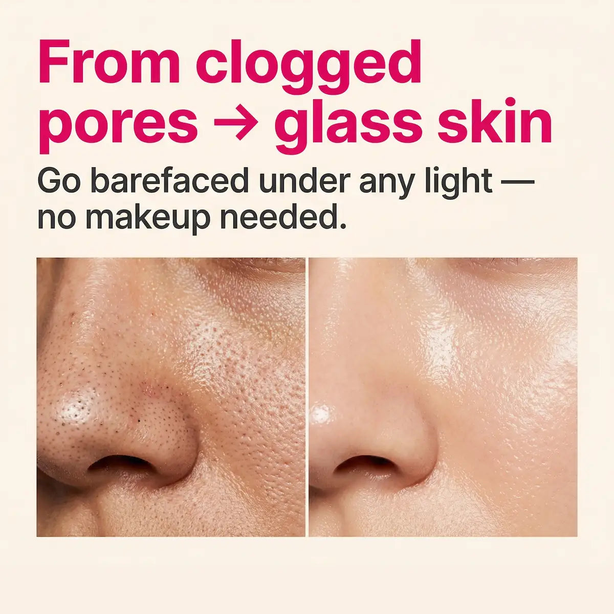 PoreVac Pro™ Deep Pore Vacuum
